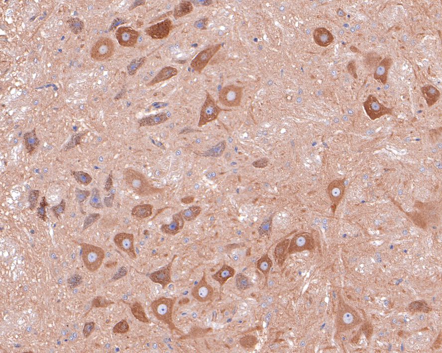 TMEM85 Antibody (JE65-17)