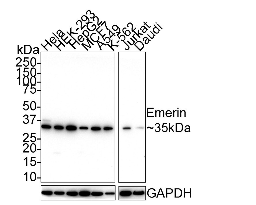Emerin Antibody (PSH01-85) Western Blot: Emerin Antibody (PSH01-85) [NBP3-32307]