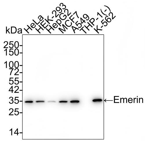 Emerin Antibody (PSH01-86) Western Blot: Emerin Antibody (PSH01-86) [NBP3-32308]