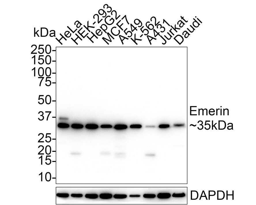 Emerin Antibody (PSH01-86) Western Blot: Emerin Antibody (PSH01-86) [NBP3-32308]