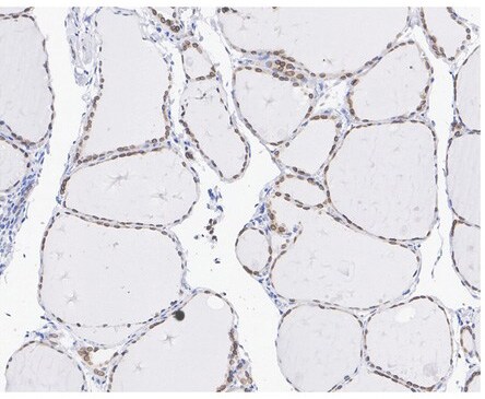 Emerin Antibody (PSH01-86)