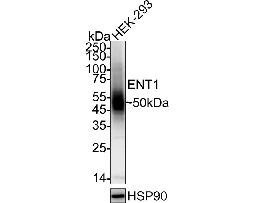 ENT1 Antibody (PD00-77) Western Blot: ENT1 Antibody (PD00-77) [NBP3-32309]