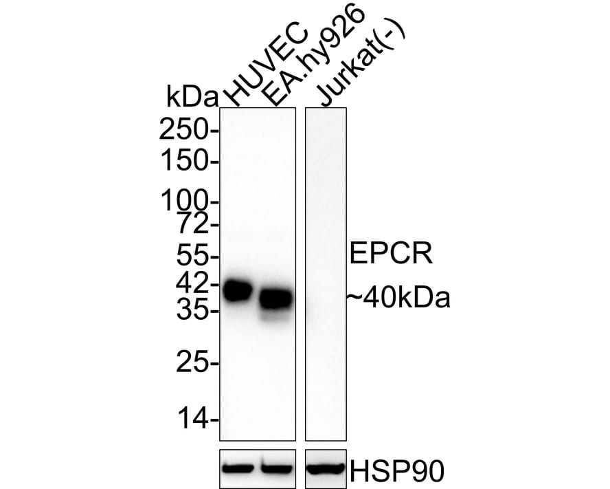 EPCR Antibody (PSH03-50) Western Blot: EPCR Antibody (PSH03-50) [NBP3-32311]