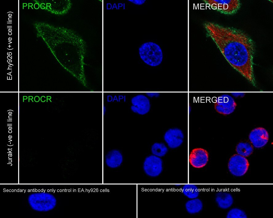 EPCR Antibody (PSH03-50)