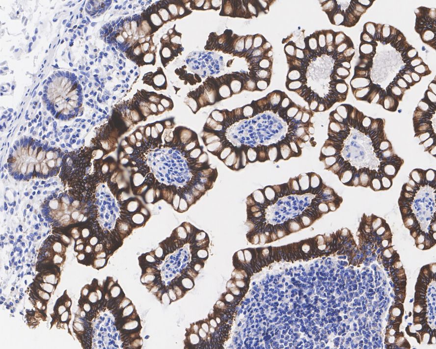 ErbB3/Her3 Antibody (PD00-44)