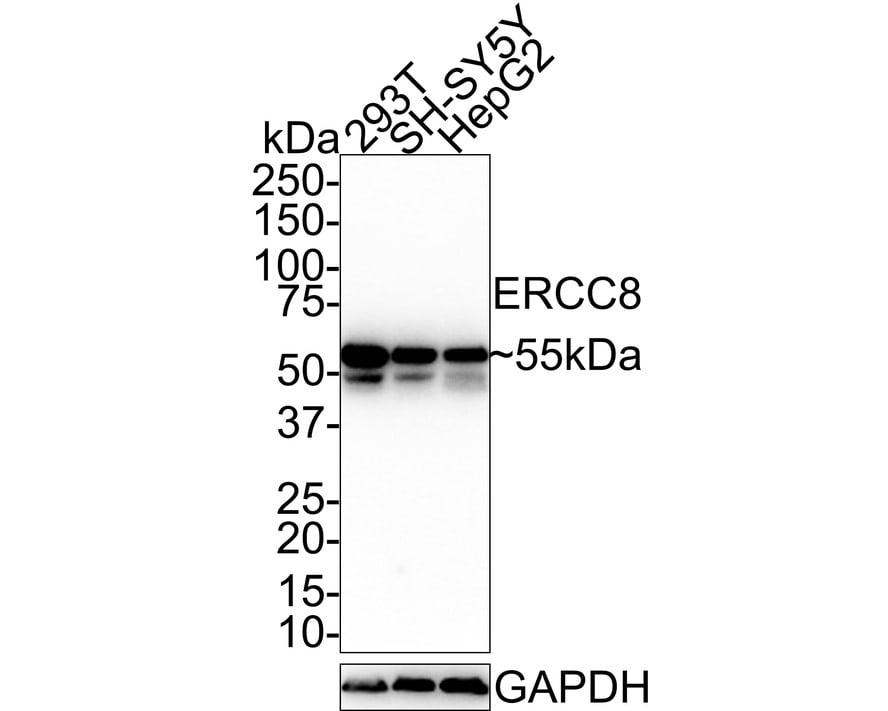 ERCC8 Antibody (PSH0-86)