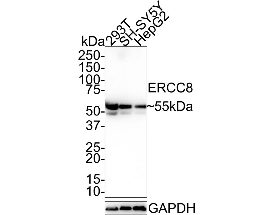 ERCC8 Antibody (PSH0-87)