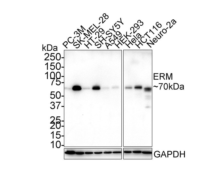 ETV5/ERM Antibody (PSH02-64) Western Blot: ETV5/ERM Antibody (PSH02-64) [NBP3-32318]