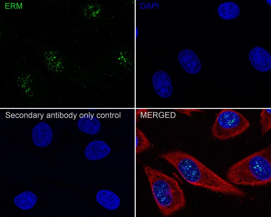 ETV5/ERM Antibody (PSH02-64)