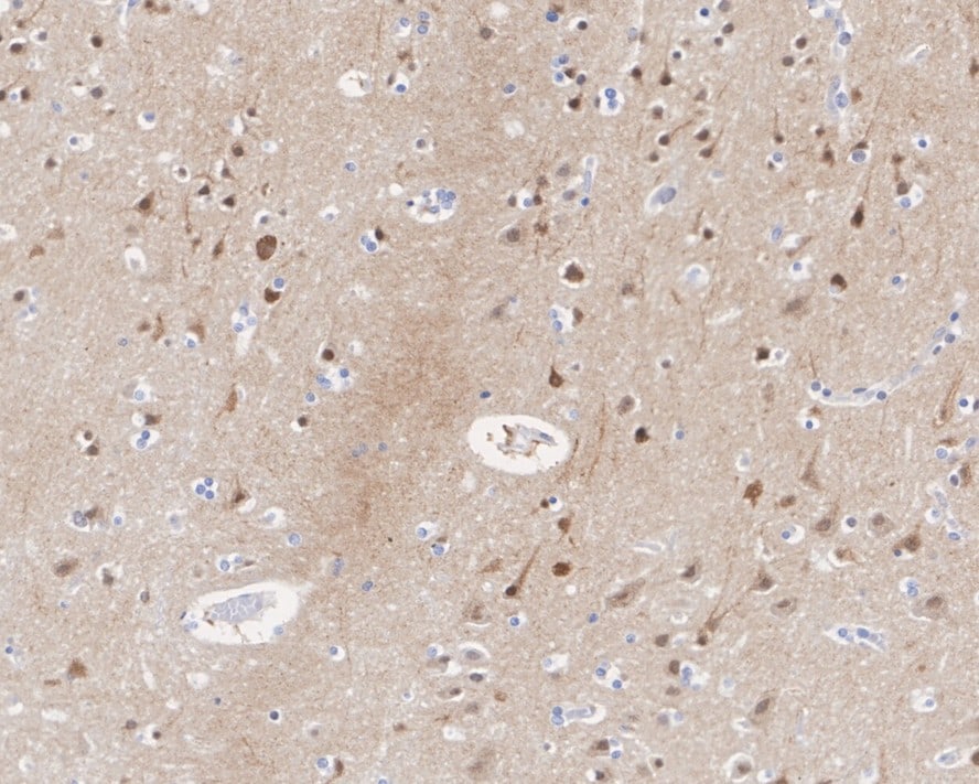ETV5/ERM Antibody (PSH02-64)