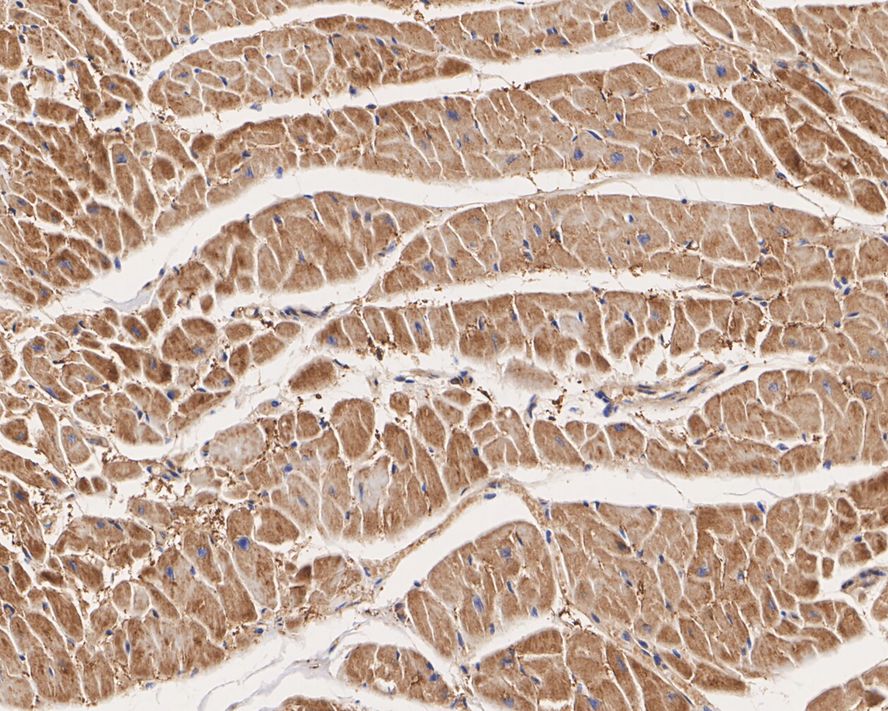 FABP3/H-FABP Antibody (JE53-37)