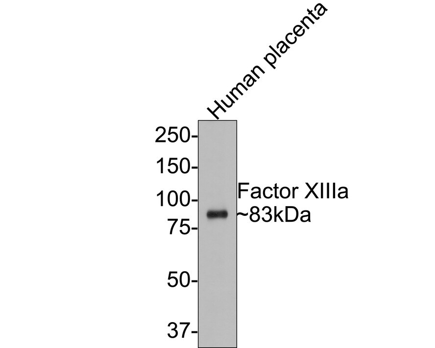 Factor XIIIa Antibody (PD00-08) Western Blot: Factor XIIIa Antibody (PD00-08) [NBP3-32326]