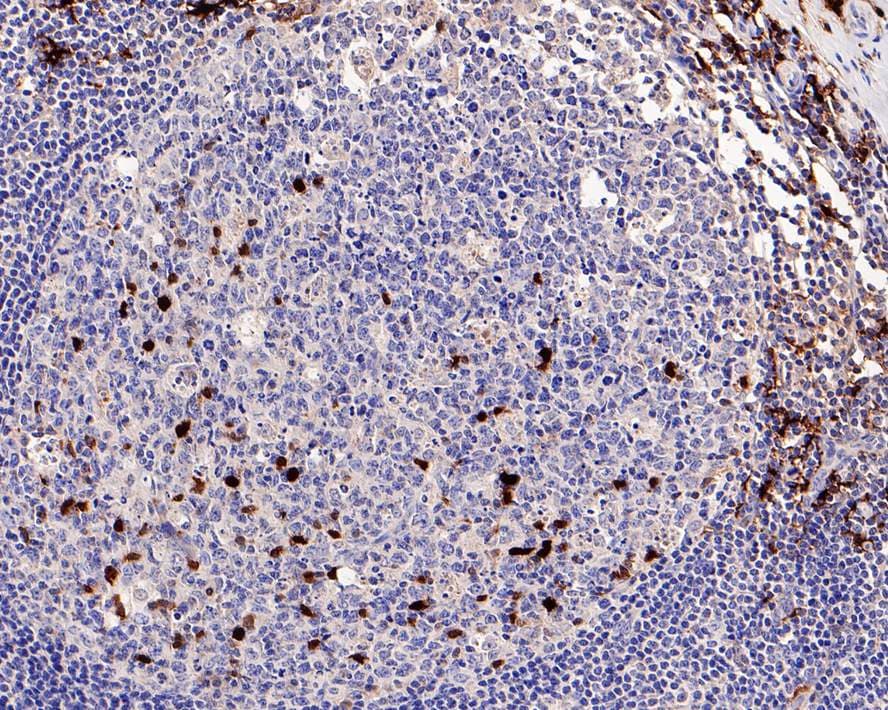 Factor XIIIa Antibody (PD00-08)