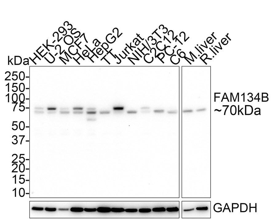FAM134B Antibody (PSH01-94) Western Blot: FAM134B Antibody (PSH01-94) [NBP3-32330]