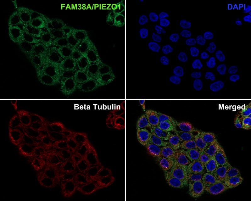 PIEZO1 Antibody (2-10-R-A)