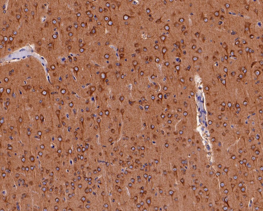 PIEZO1 Antibody (2-10-R-A)