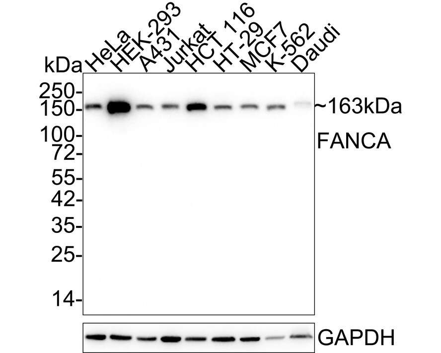 FACA/FANCA Antibody (JE36-22) Western Blot: FACA/FANCA Antibody (JE36-22) [NBP3-32333]