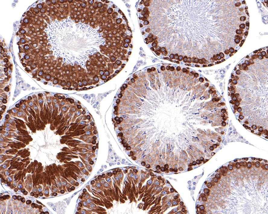 FGFR1OP Antibody (JE64-24)