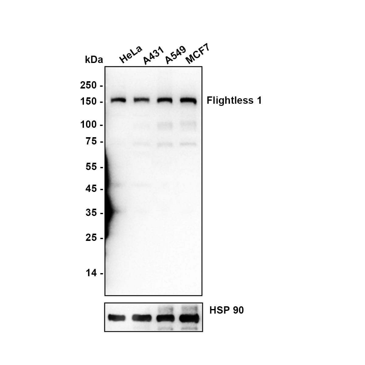 Flightless I Antibody Western Blot: Flightless I Antibody [NBP3-32341]