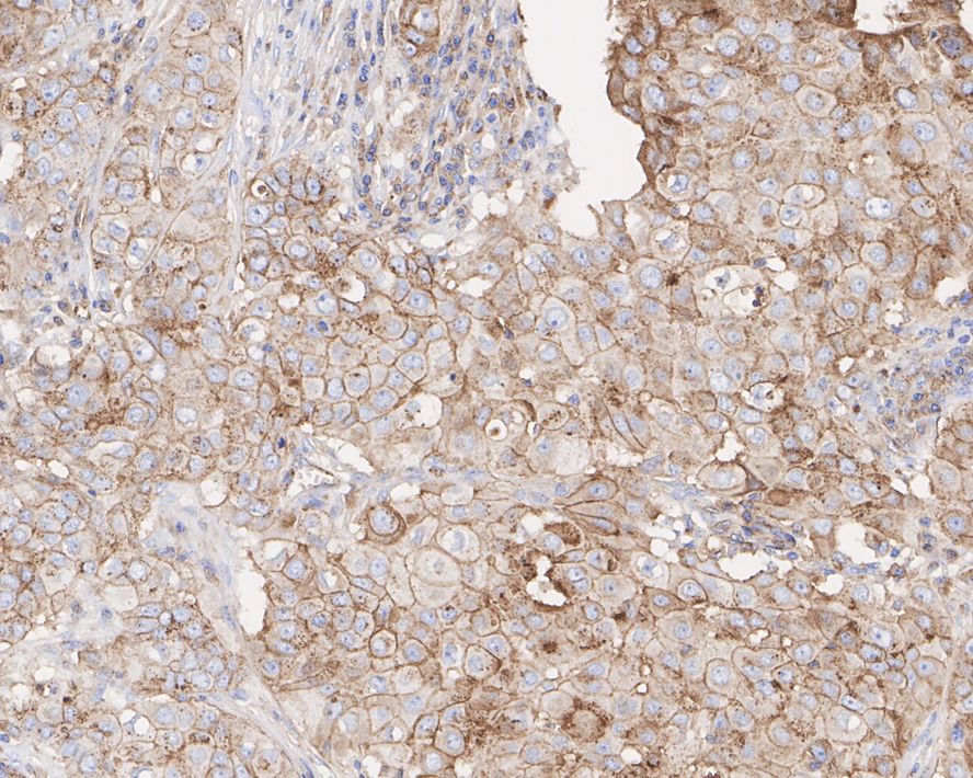 Flotillin 2 Antibody (PSH03-41)