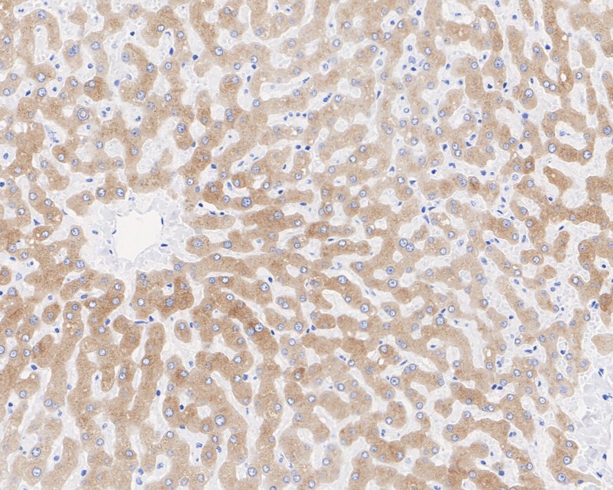 FMO3 Antibody (JE55-13)