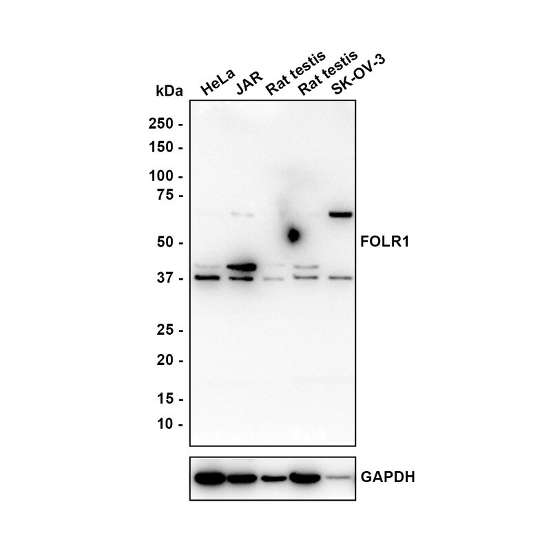 FOLR1 Antibody (JE31-40) Western Blot: FOLR1 Antibody (JE31-40) [NBP3-32345]