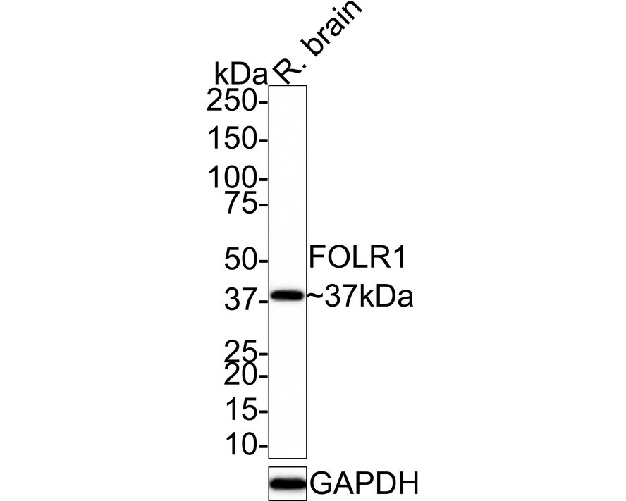 FOLR1 Antibody (JE31-40) Western Blot: FOLR1 Antibody (JE31-40) [NBP3-32345]