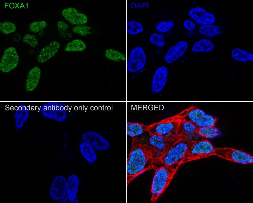 HNF-3 alpha/FoxA1 Antibody (A2E8-R)