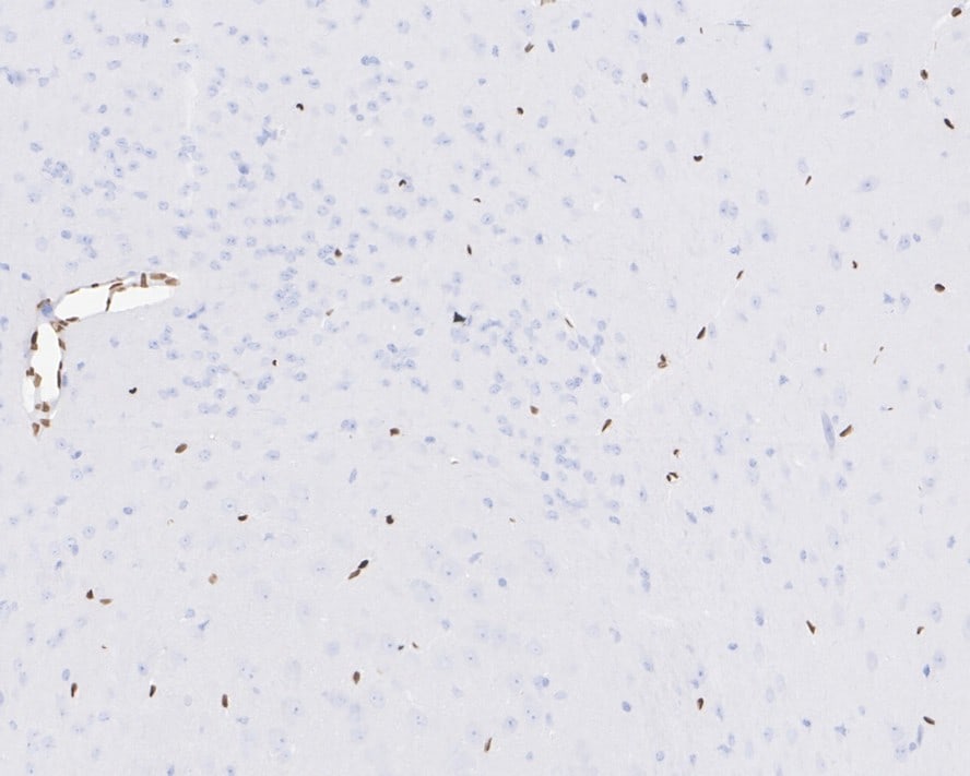 FoxC1 Antibody (PSH03-89)