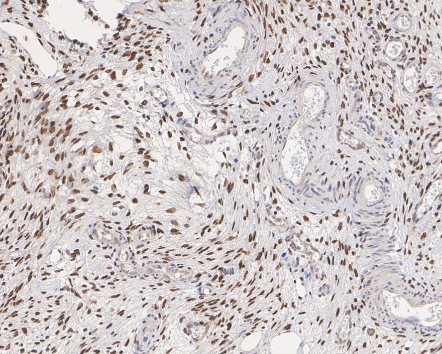 FOXL2 Antibody (JE38-52)