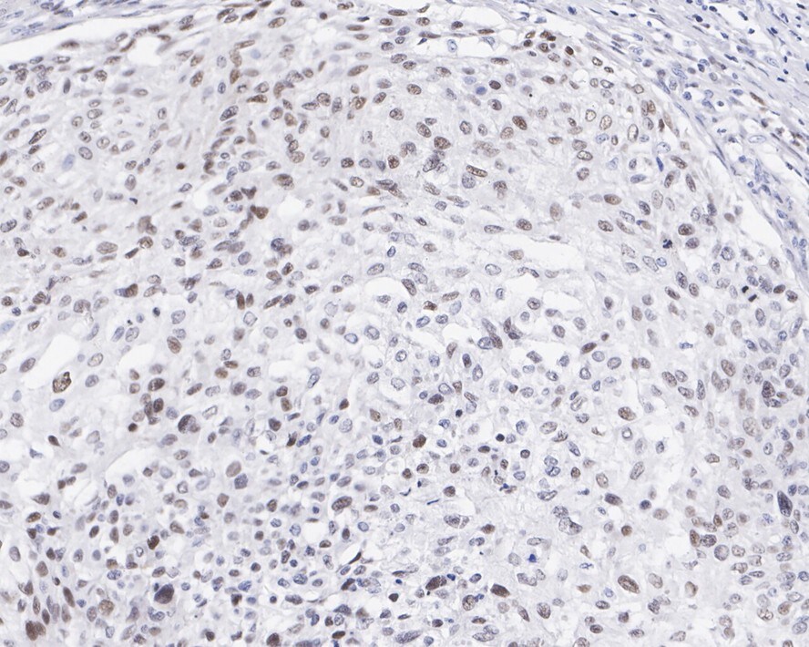 FRA-1/FOSL1 Antibody (JE33-20)