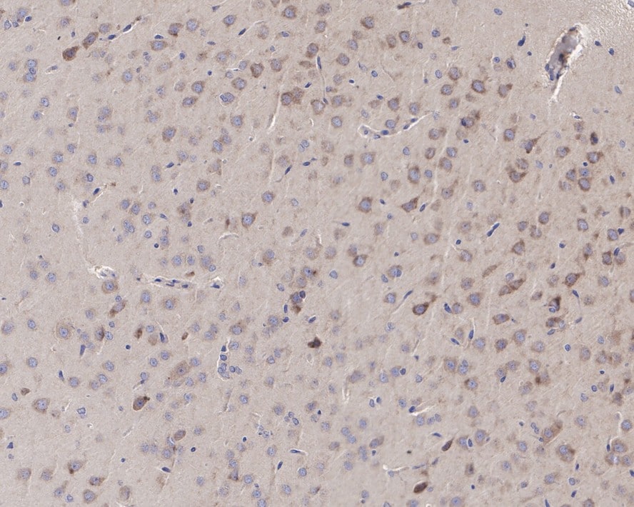 FUNDC1 Antibody (PSH0-92)
