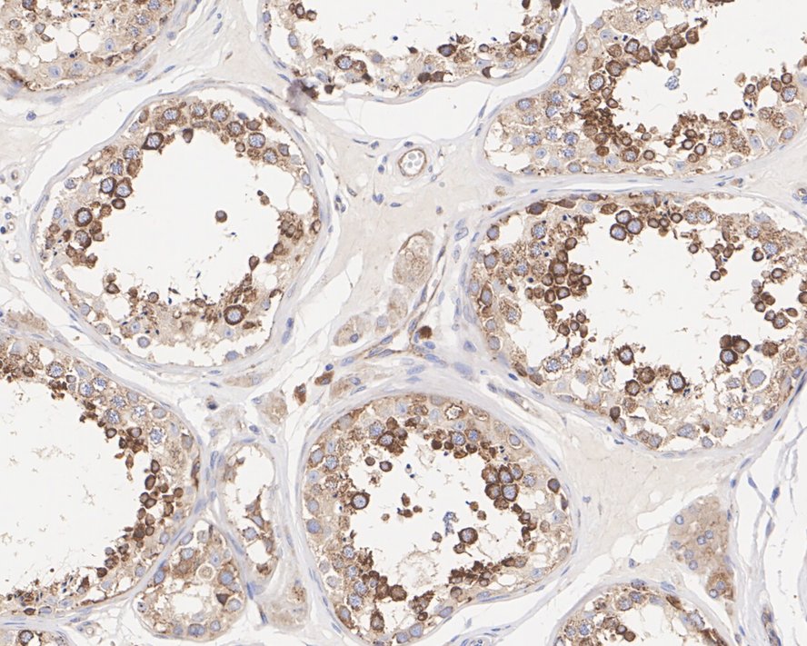 FXR1 Antibody (PSH01-35)