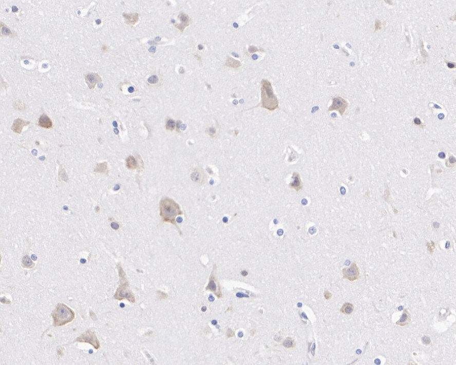 FXR1 Antibody (PSH01-67)