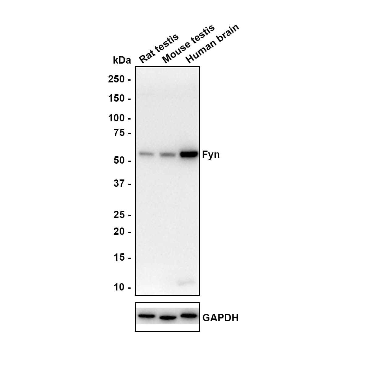 Fyn Antibody (JE42-22) Western Blot: Fyn Antibody (JE42-22) [NBP3-32357]