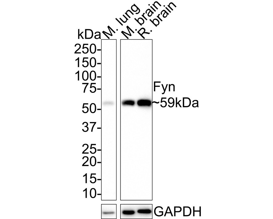 Fyn Antibody (JE42-22) Western Blot: Fyn Antibody (JE42-22) [NBP3-32357]