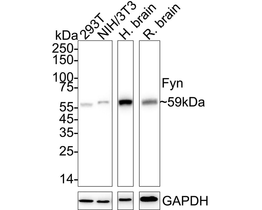 Fyn Antibody (JE42-22) Western Blot: Fyn Antibody (JE42-22) [NBP3-32357]