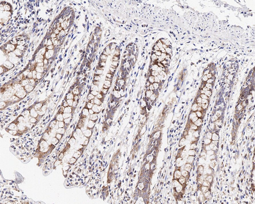 G3BP1 Antibody (JE35-20)