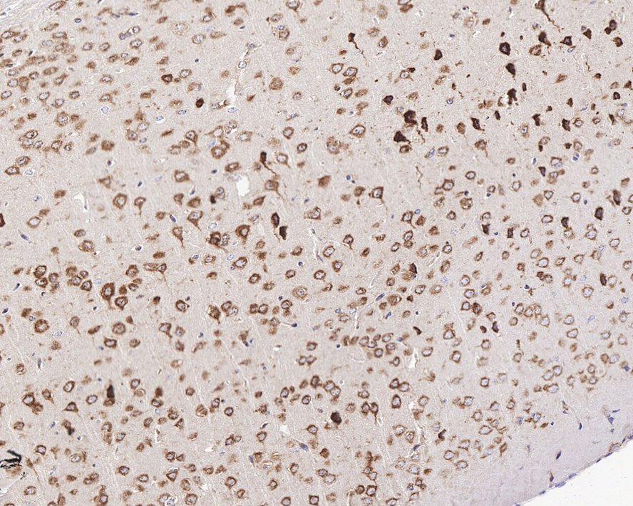 GABA-B R1 Antibody (JE60-09)