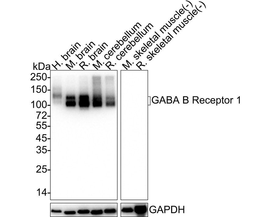 GABA-B R1 Antibody (PSH03-87) Western Blot: GABA-B R1 Antibody (PSH03-87) [NBP3-32360]