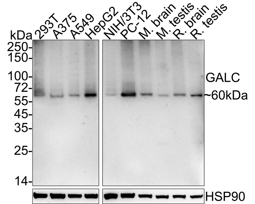 Galactosylceramidase/GALC Antibody (PSH03-45) Western Blot: Galactosylceramidase/GALC Antibody (PSH03-45) [NBP3-32361]