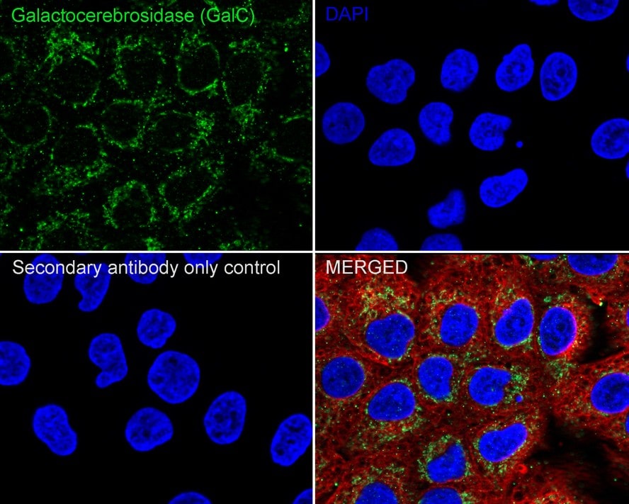 Galactosylceramidase/GALC Antibody (PSH03-45)