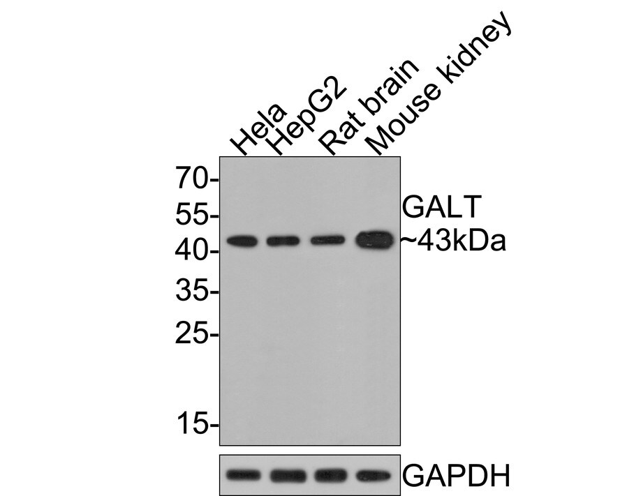 GALT Antibody (JE64-66) Western Blot: GALT Antibody (JE64-66) [NBP3-32362]