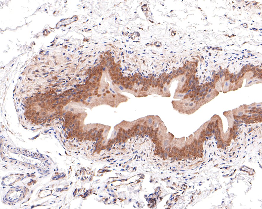 GALT Antibody (JE64-66)