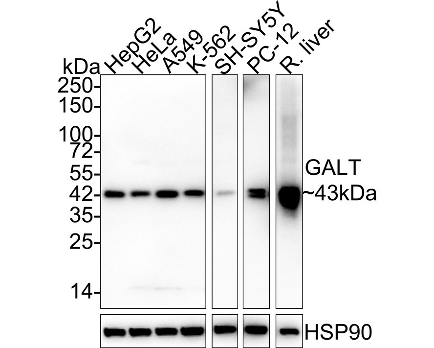 GALT Antibody (PSH02-87) Western Blot: GALT Antibody (PSH02-87) [NBP3-32363]