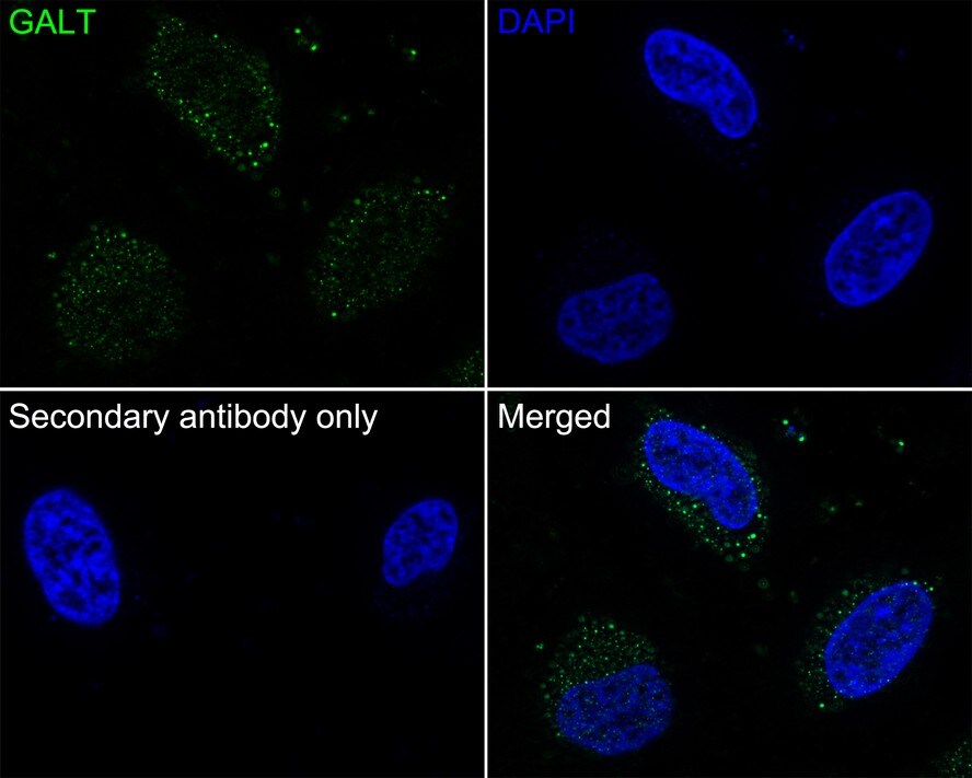 GALT Antibody (PSH02-87)
