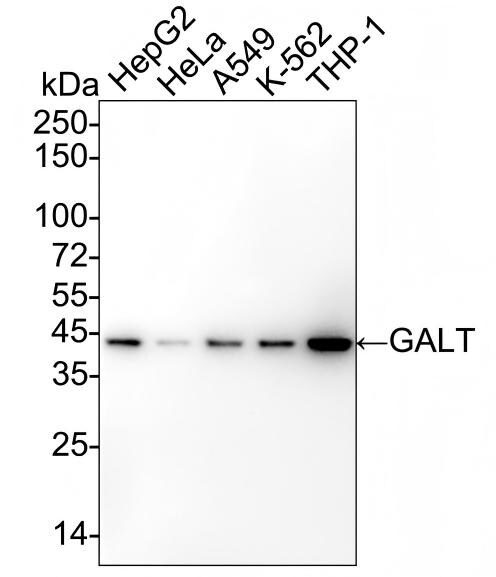 GALT Antibody (PSH02-88) Western Blot: GALT Antibody (PSH02-88) [NBP3-32364]