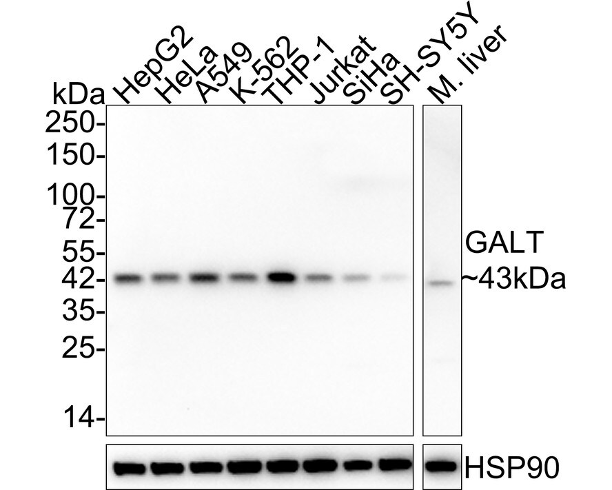 GALT Antibody (PSH02-88) Western Blot: GALT Antibody (PSH02-88) [NBP3-32364]