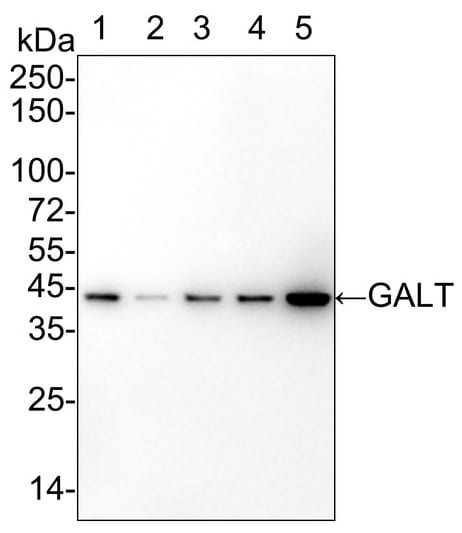 GALT Antibody (PSH02-88)