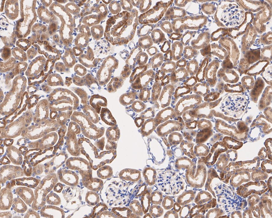 Gamma Adaptin Antibody (PSH02-65)